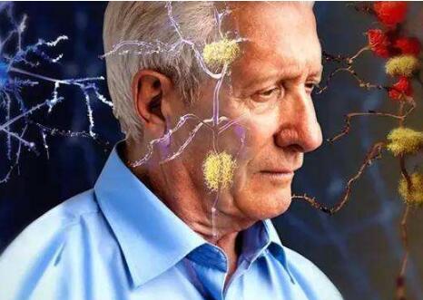 老年痴呆症可以早期预防吗（5个要点预防老年痴呆症）？